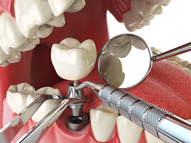 Best Weekend Emergency Dentist in Reliez Valley, CA