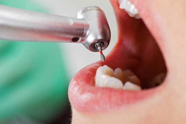Best Same-Day Emergency Dental Services in Reliez Valley, CA